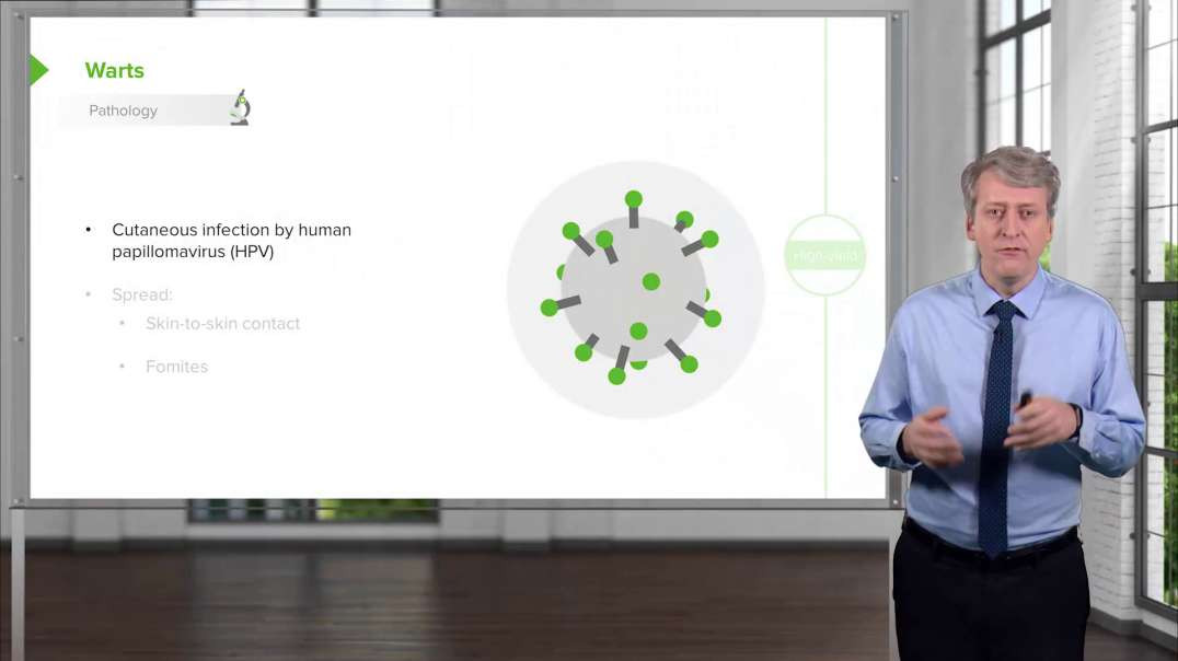 Lecturio - Warts (Verruca Vulgaris) and Molluscum Contagiosum in Children