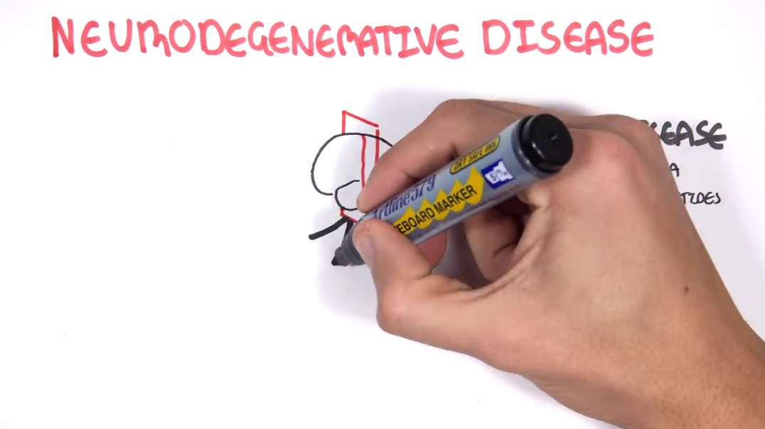 Armando - Neurodegenerative Disease Overview