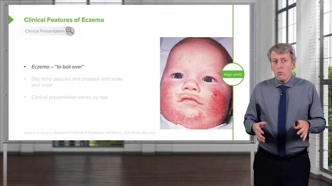 Lecturio Eczema in Children