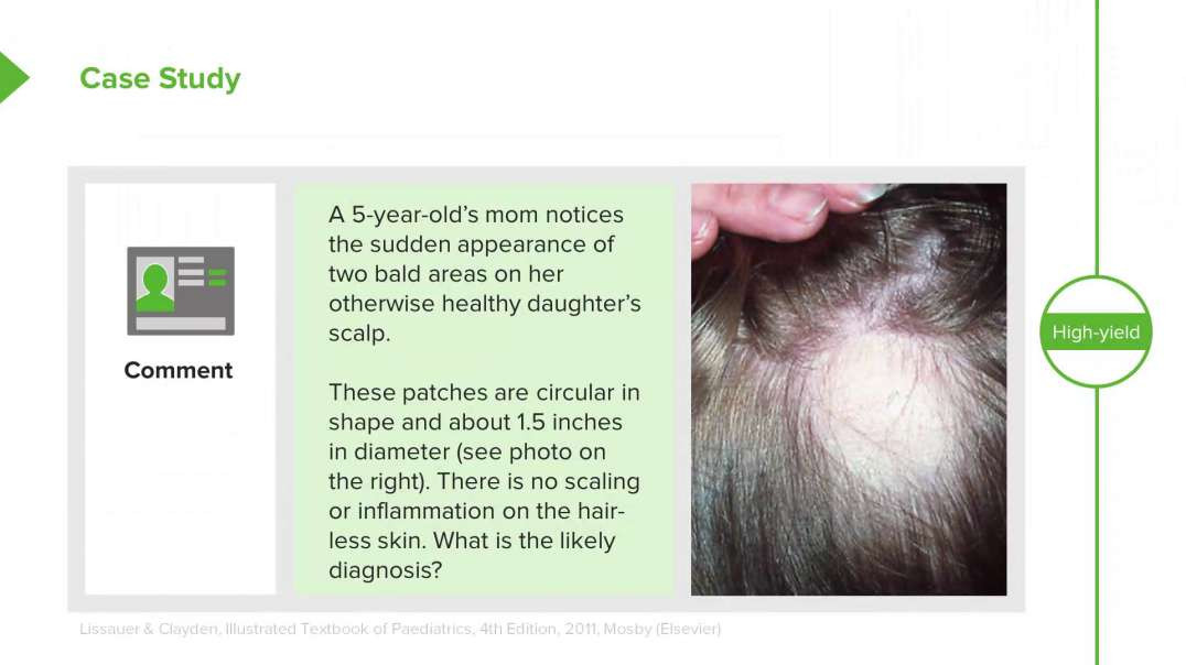 Lecturio - Hair Loss in Children Alopecia Areata, Nevus Sebaceus, Traction Alopecia Trichotillomania