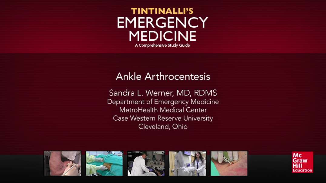 Ankle Arthrocentesis