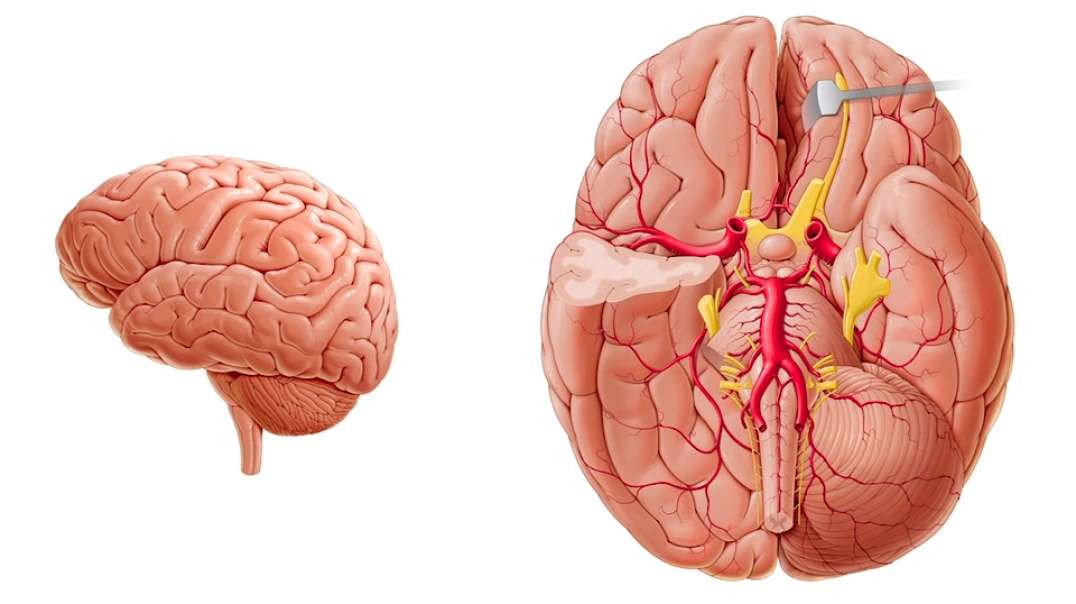 Arteries of the brain II