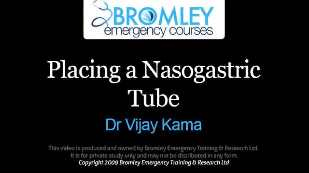 Placing a Nasogastric Tube