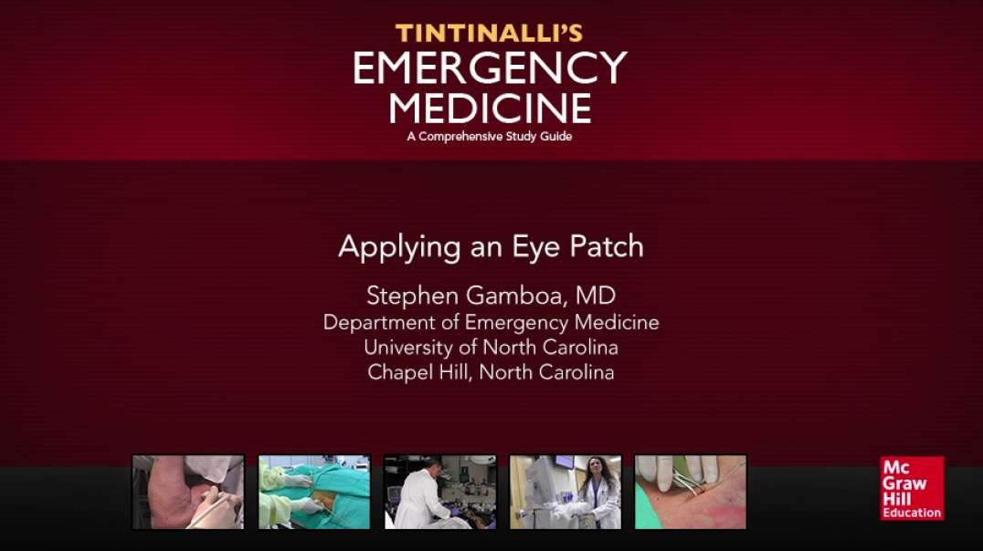 Applying an Eye Patch