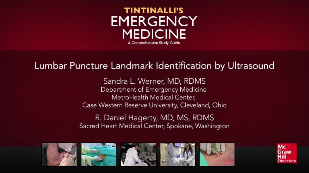 Lumbar Puncture Landmark Identification by Ultrasound