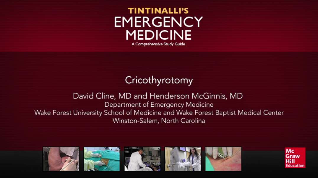 Cricothyrotomy