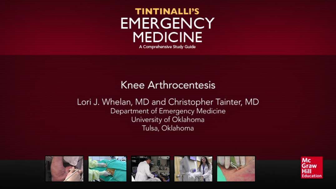 Knee Arthrocentesis