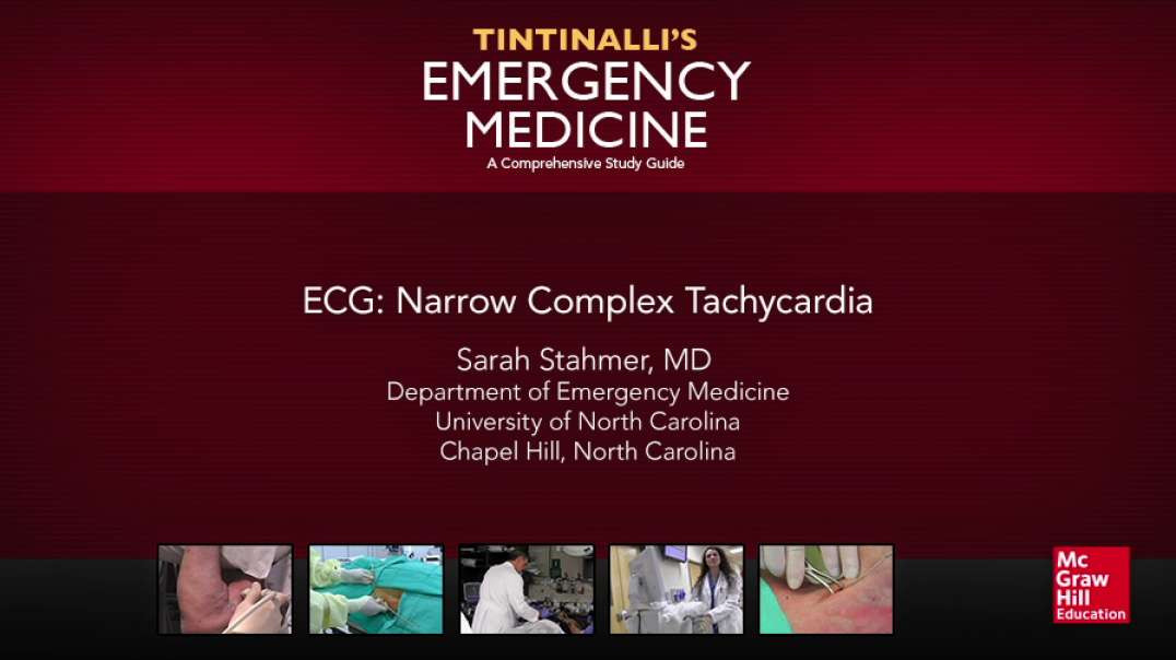 ECG Narrow Complex Tachycardia