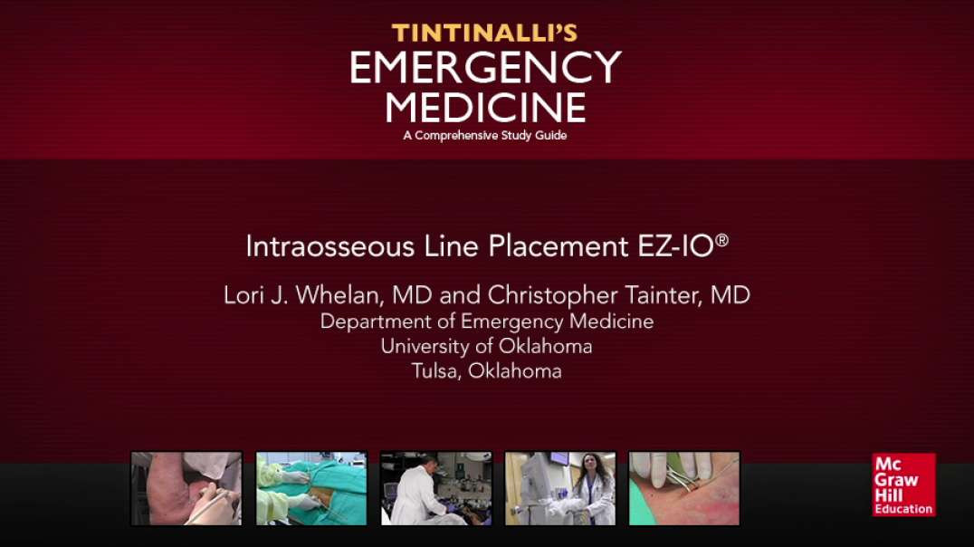 Intraosseous Line Placement EZ-IO