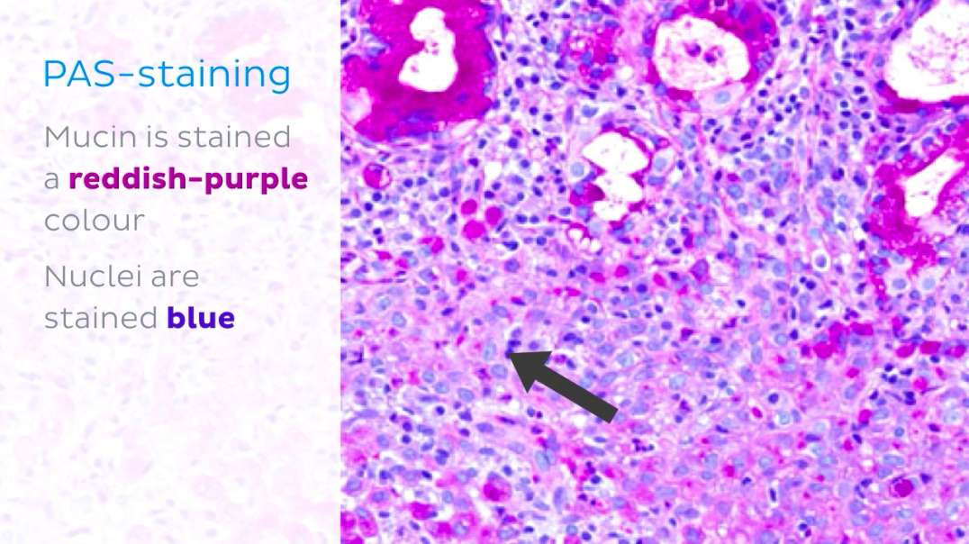Basic histological staining methods