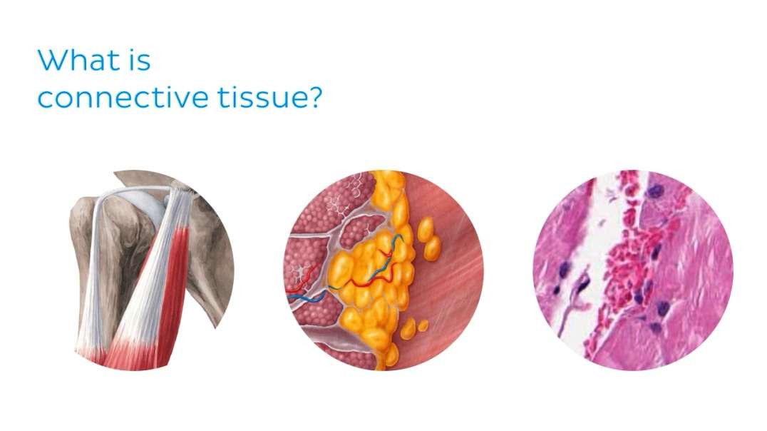 Dense connective tissue
