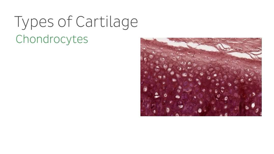 What is cartilage