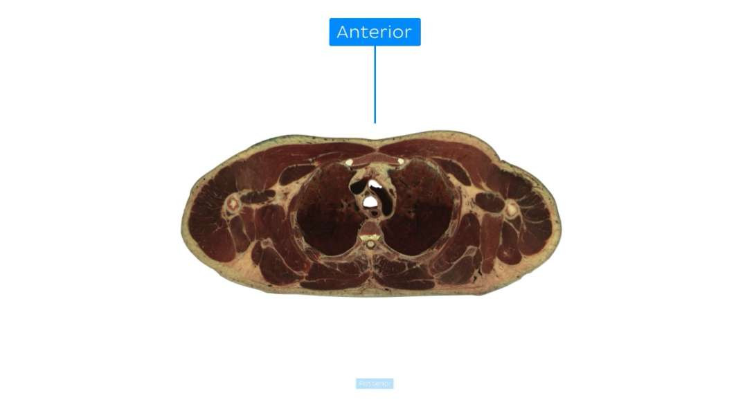 Coracobrachialis muscle level
