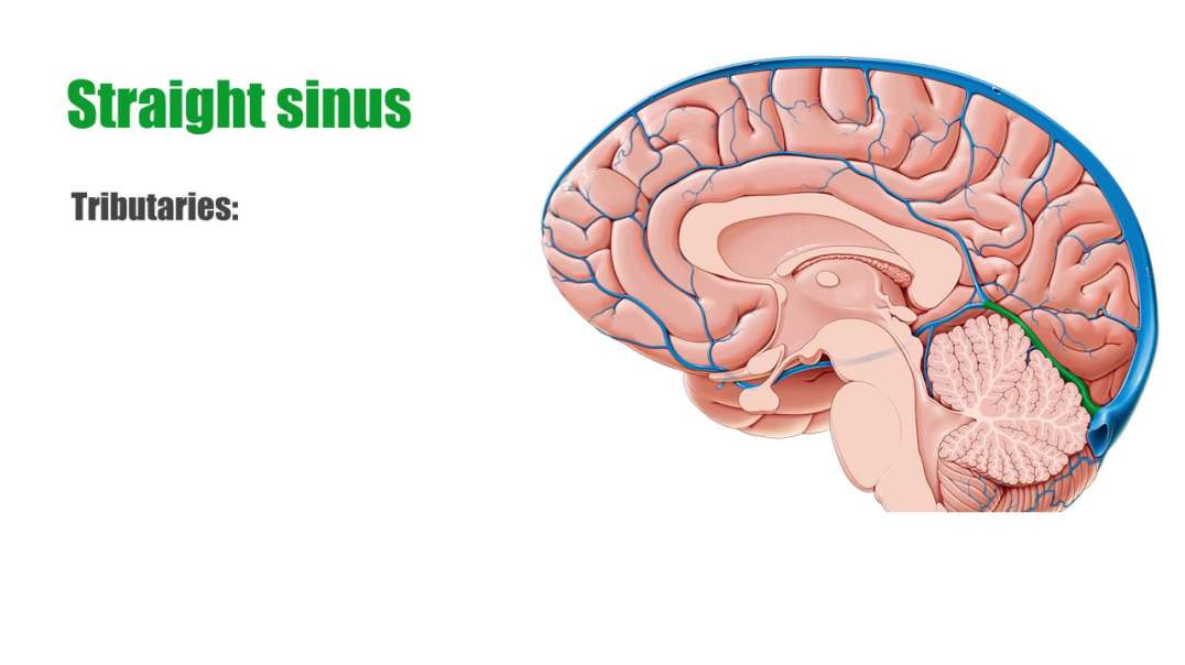 Straight sinus