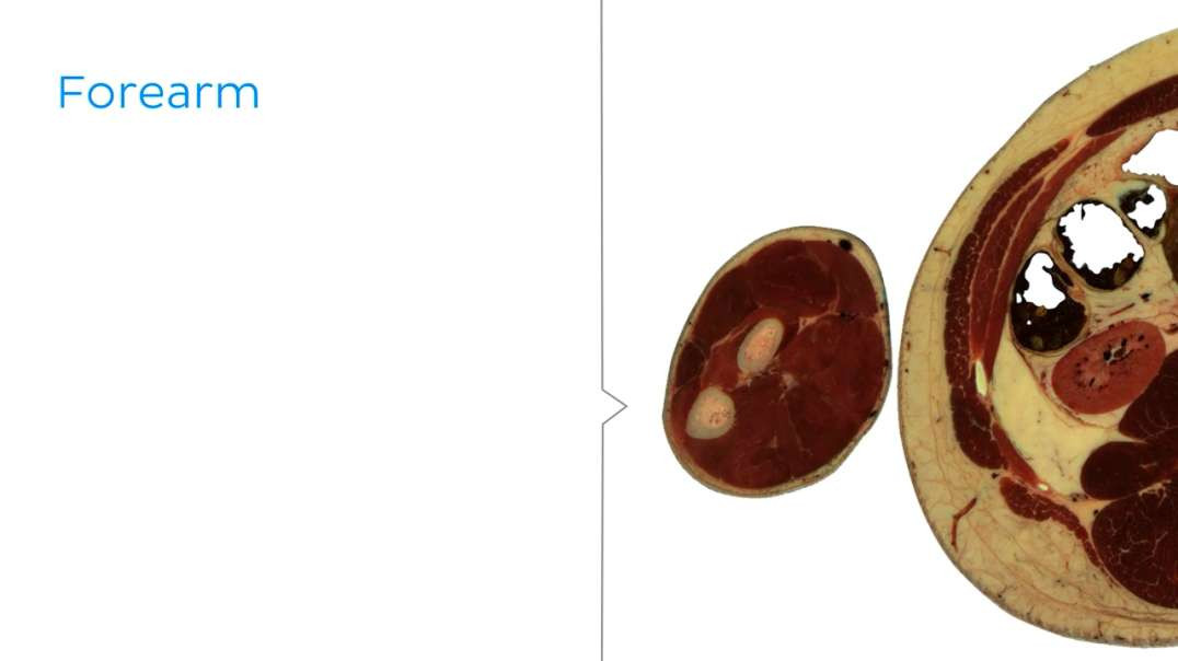 Cross section of upper extremity