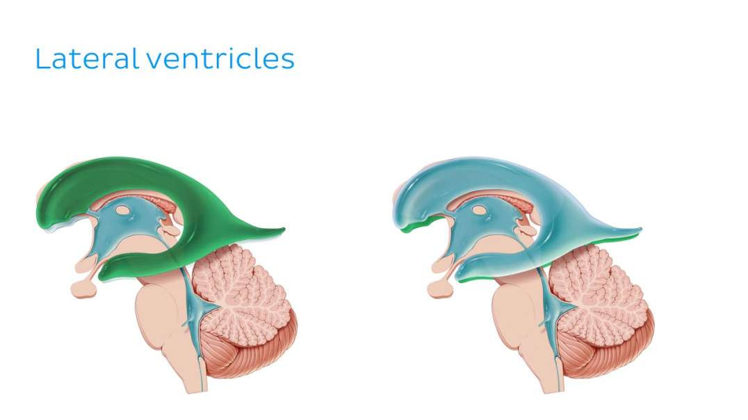 Ventricles of the brain