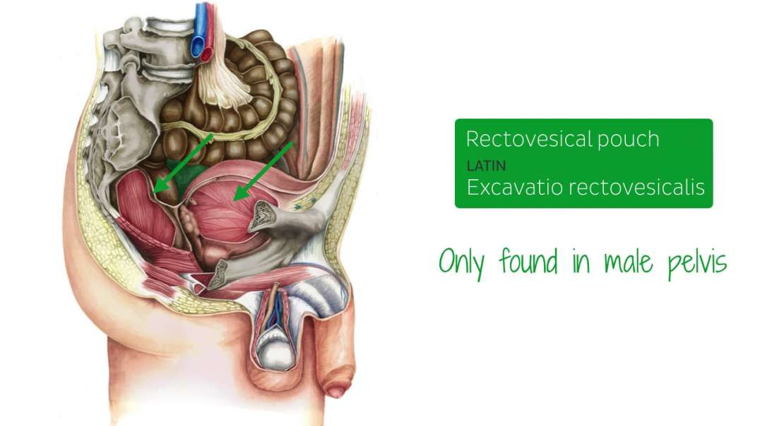 Rectovesical pouch