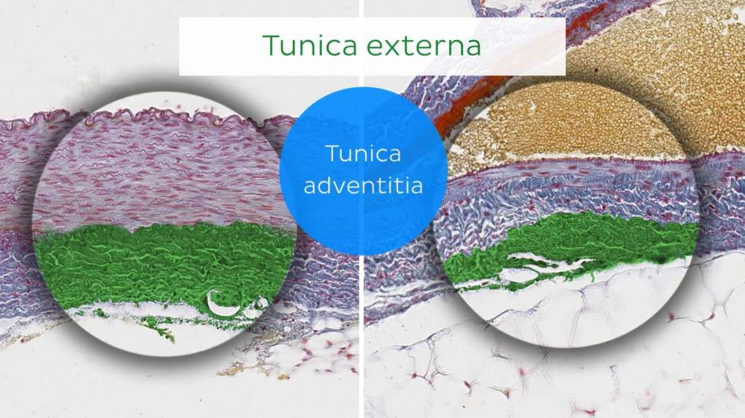 Arteries and veins histology