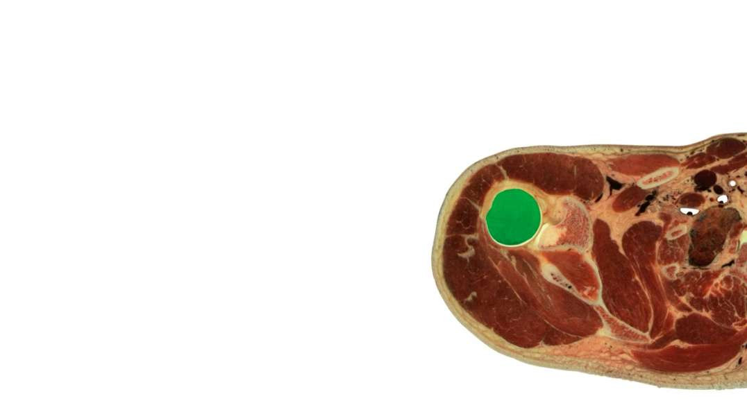 Cross section of upper extremity