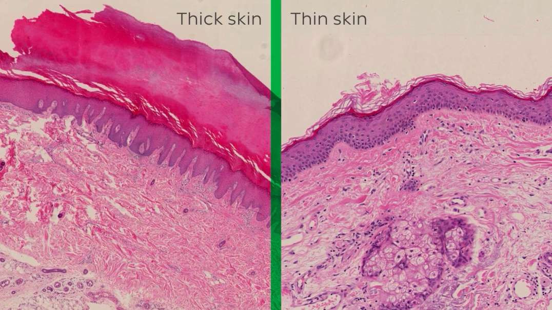 Integumentary system