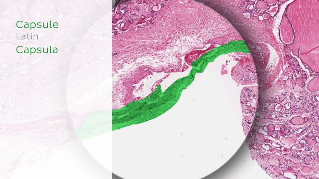 Thyroid Gland (Histology)