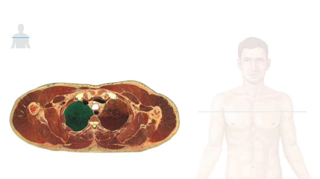3rd Thoracic Vertebra Level