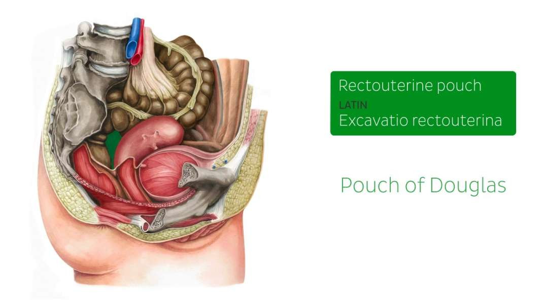 Rectouterine pouch
