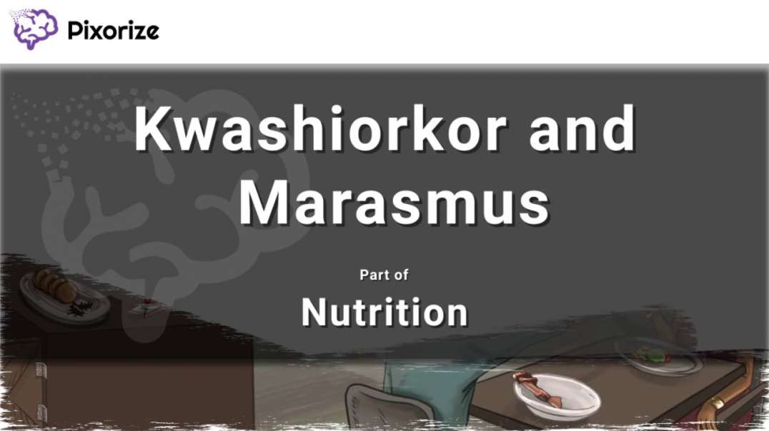 Kwashiorkor _ Marasmus